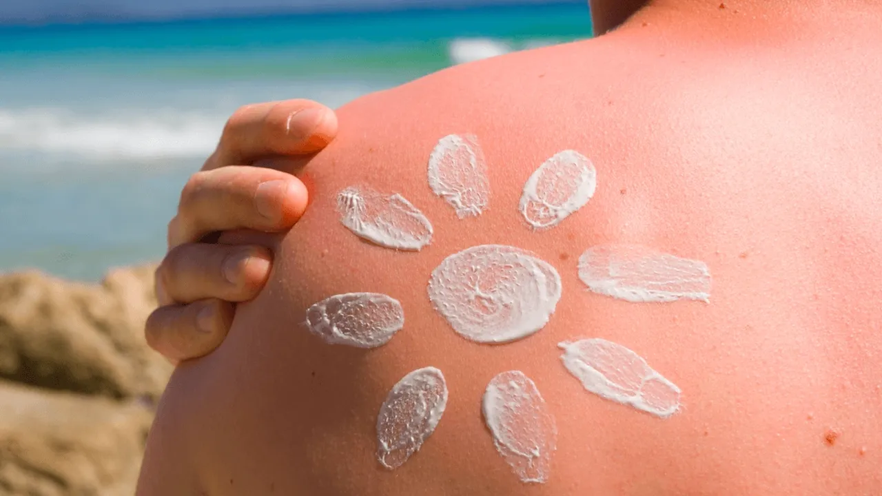 Güneş yanığına dikkat!